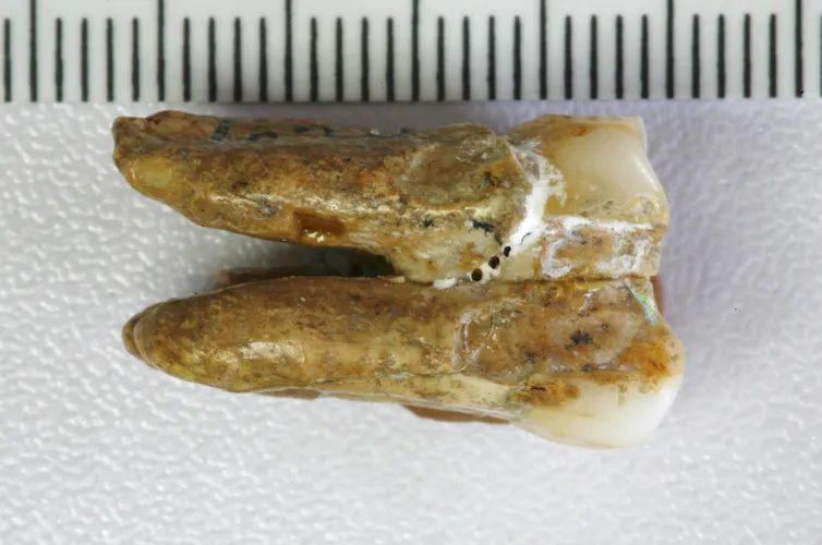 A tooth from the Zhoukoudian site that was used in the analysis.