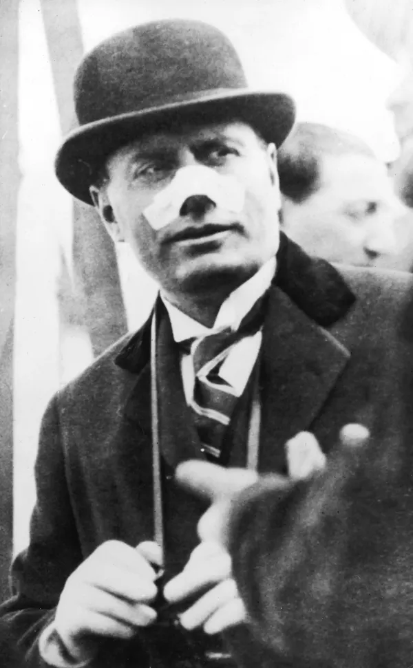 Archive image of Benito Mussolini with bandage on his nose.