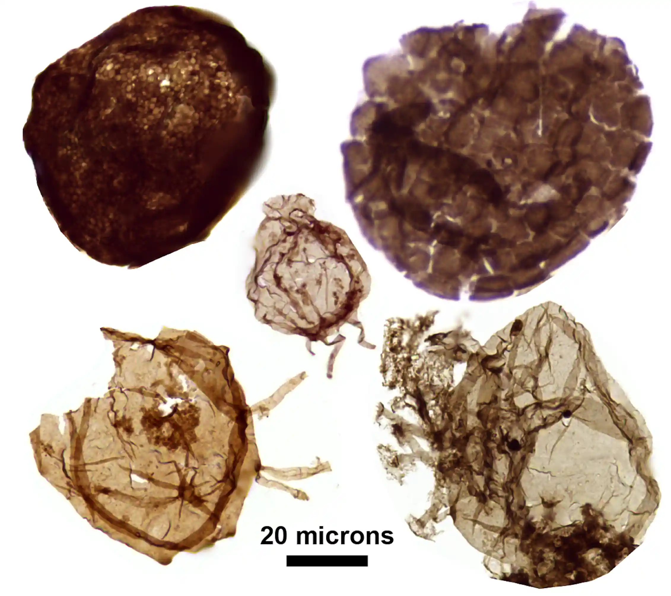 A microscopic image of five fossils.