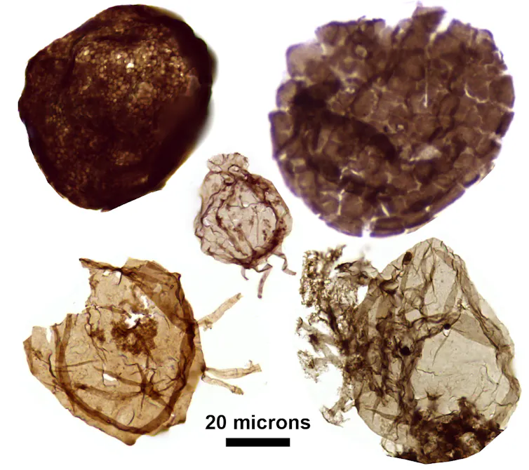 A microscopic image of five fossils.