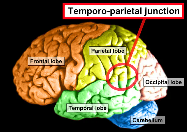 diagram of brain with lobes labeled and TPJ region circled in the middle