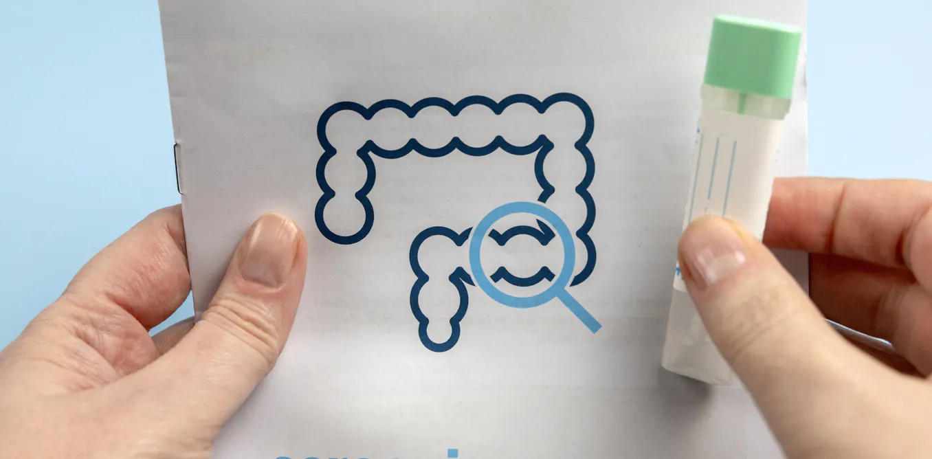 EduWireDaily — Poop tests and blood tests join colonoscopy as options for colorectal cancer screening