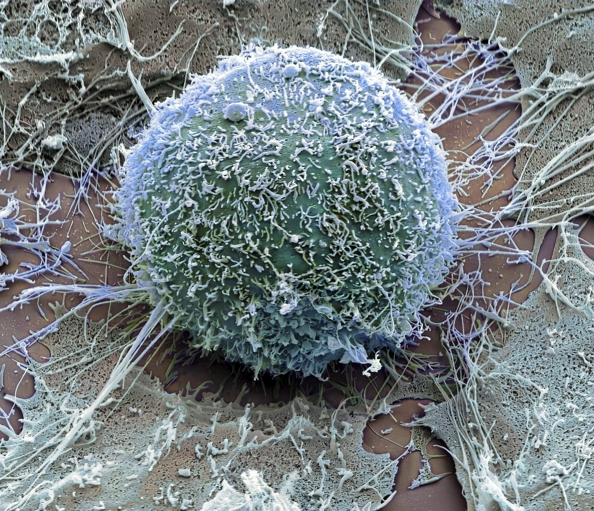 South African scientists make breakthrough in decoding cancer’s most effective survival strategy