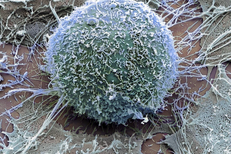 Bluish spherical object with filaments