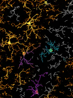 Microscopy image of brain cells with short, kinky filaments extending from small circles