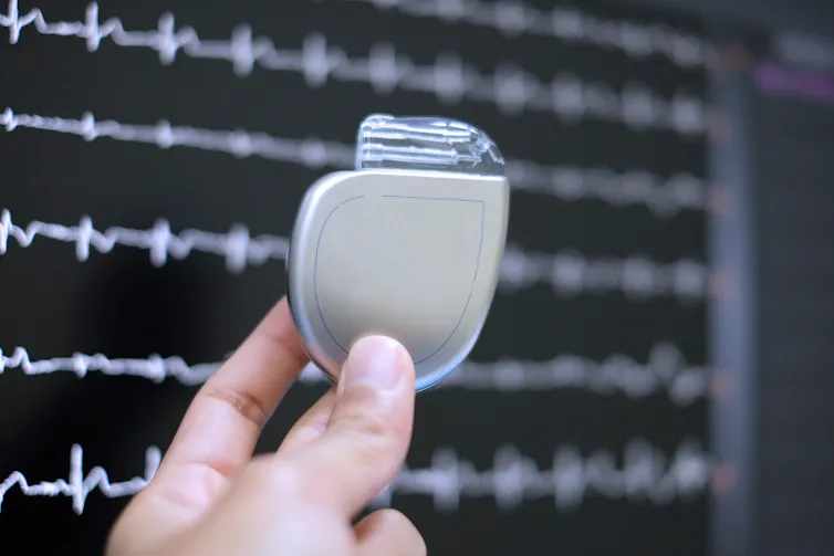 A person holds a silver implantable cardioverter defibrillator (ICD) in their hands.