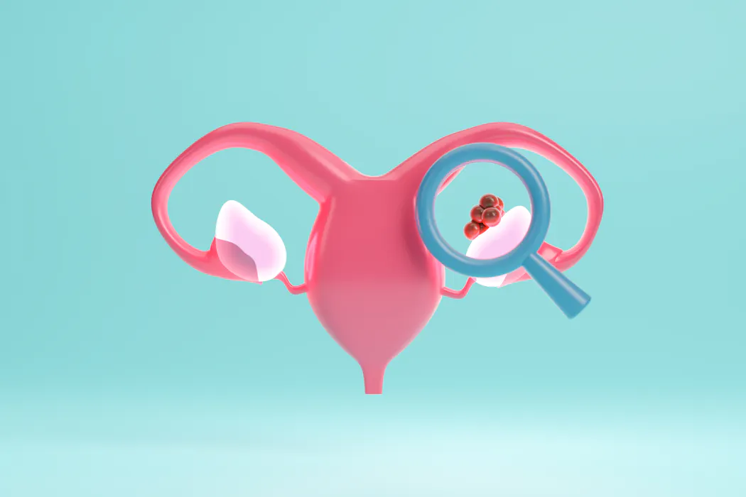 Ovarian cancer drug approved for NHS use will prolong lives