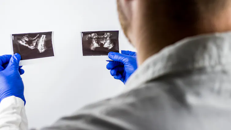 A doctor examines ultrasound images of prostate gland