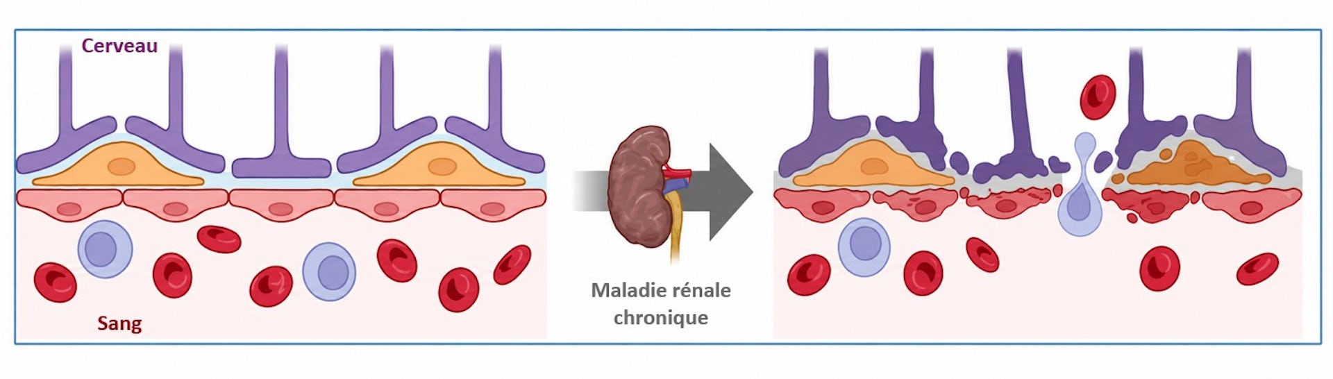A simplified diagram of the changes in the blood-brain barrier that occur during kidney disease