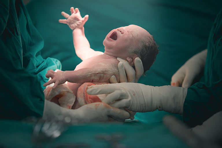 Doctor and nurse are pulling a new born baby from mother's abdomen