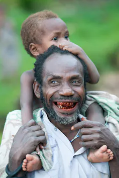 A man with teeth stained red.