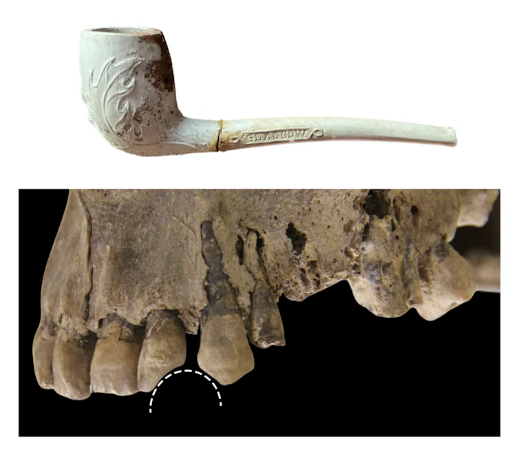 Photos of a clay pipe and teeth with a rounded notch.