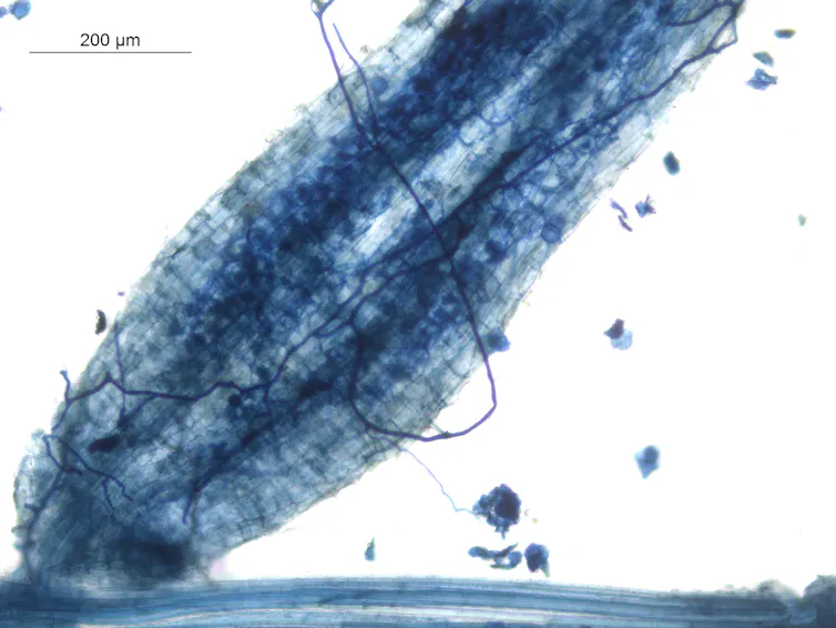 A microscope image of fungi in and around a plant root