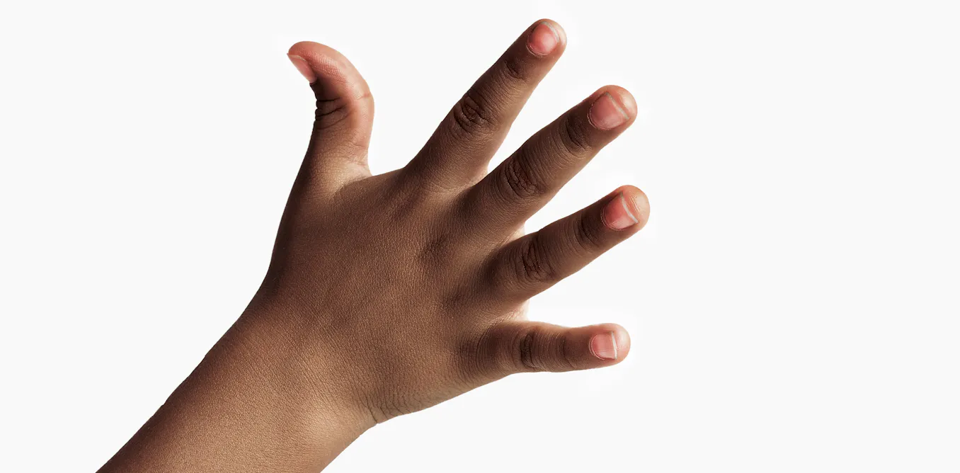 Why are our fingers different lengths? Why are our fingers different lengths?