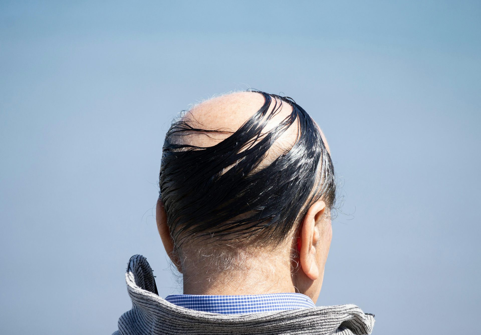 A man with a bad combover.