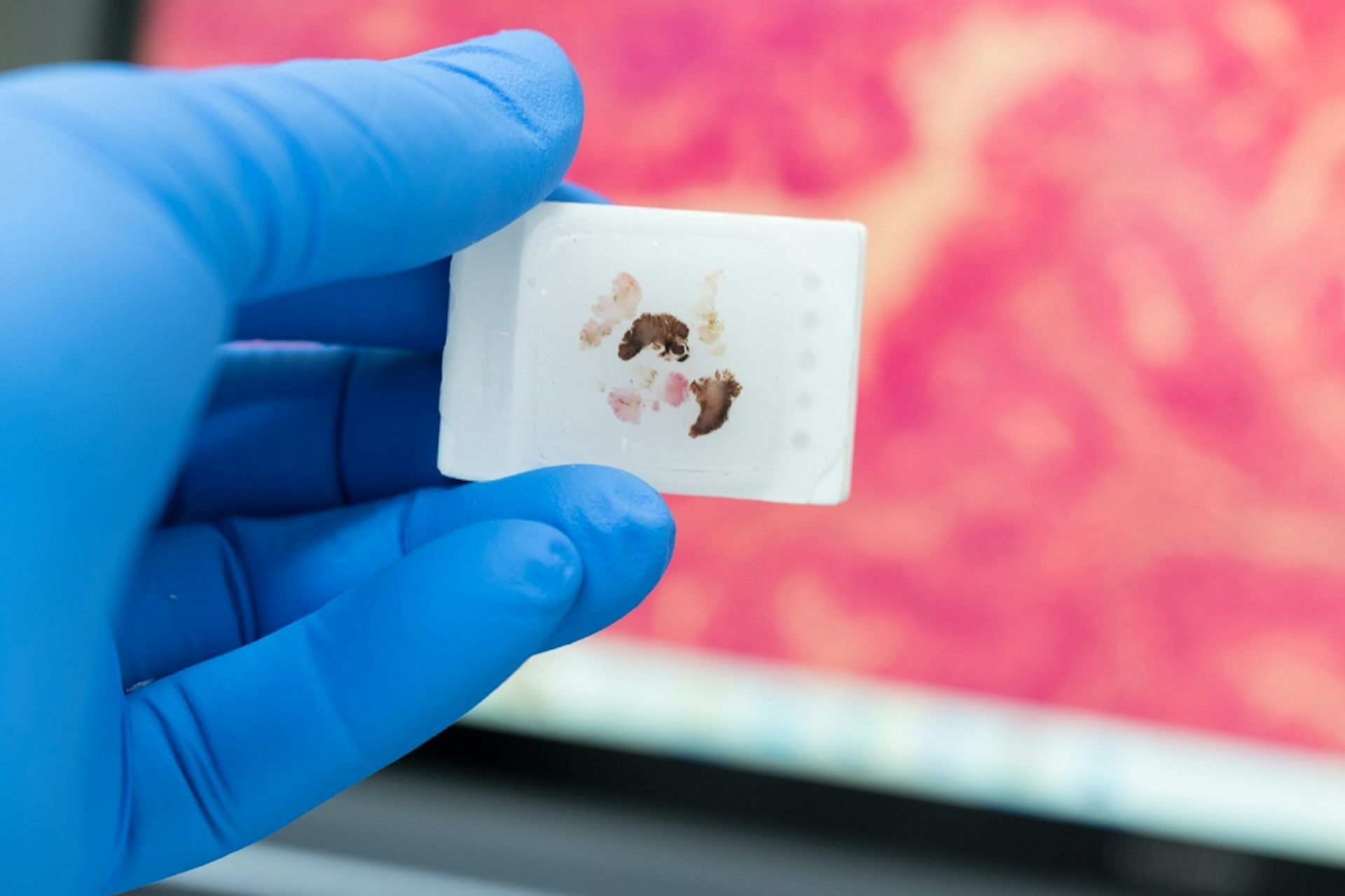A gloved hand holds a tissue sample.