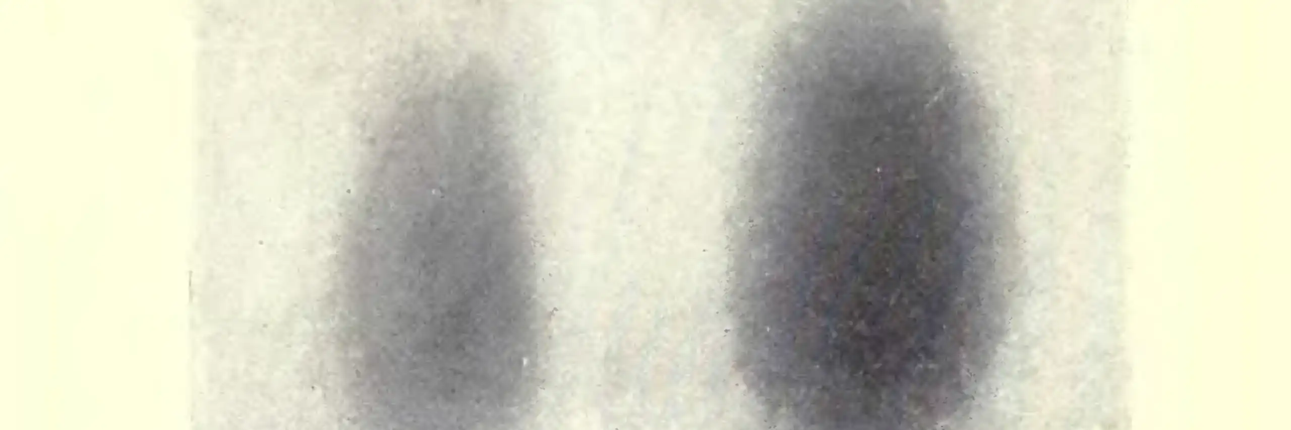 Photogravures supposées mettre en évidence les rayons N, dans une communication faite par Blondlot à l'Académie des sciences.