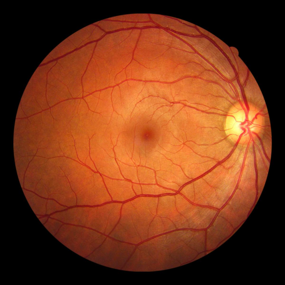 Look Your Eyes Are Wired Backwards Here S Why