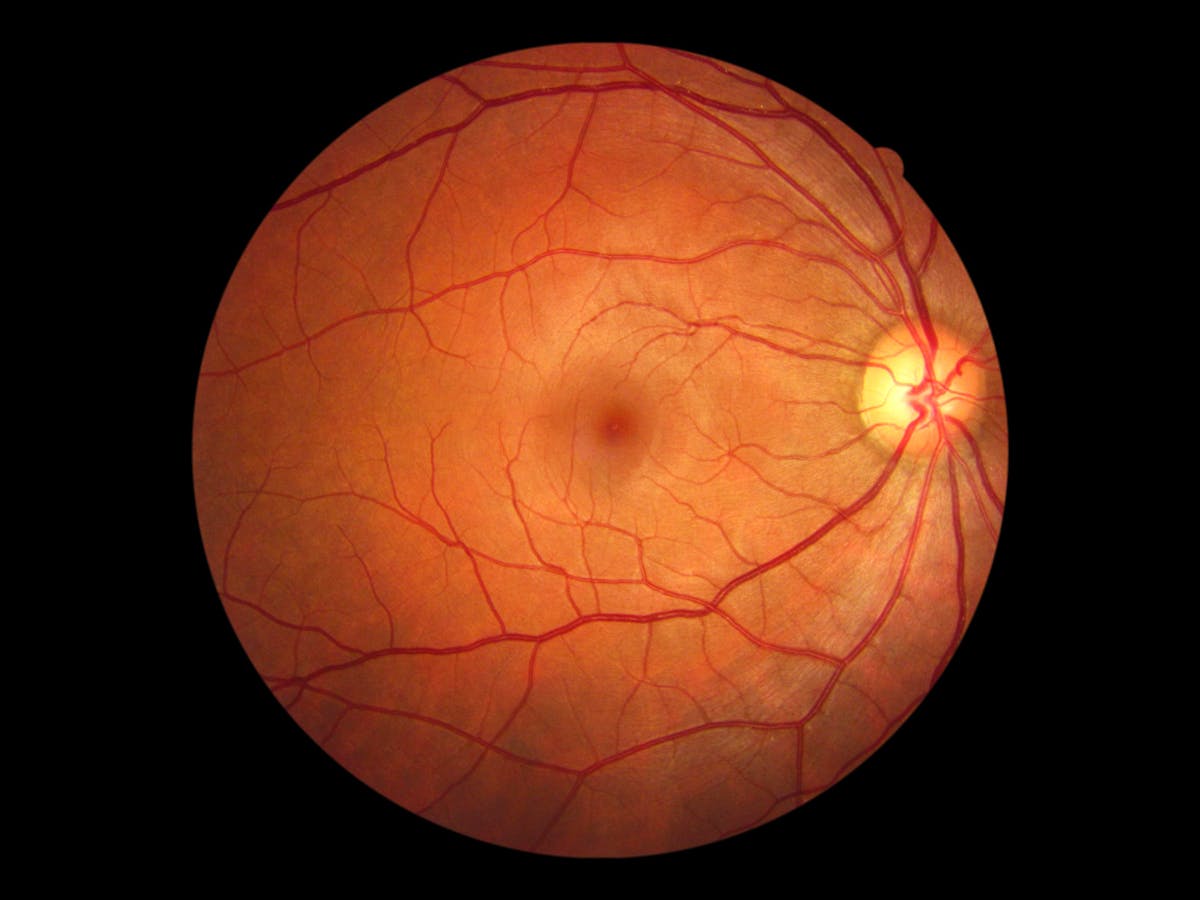 Look Your Eyes Are Wired Backwards Here S Why