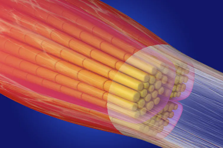 Illustration of a bundle of dozens of yellow tubes in a translucent membrane