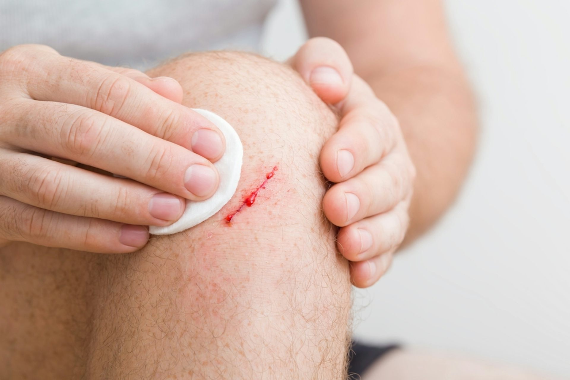 A man with a scratch on his knee.