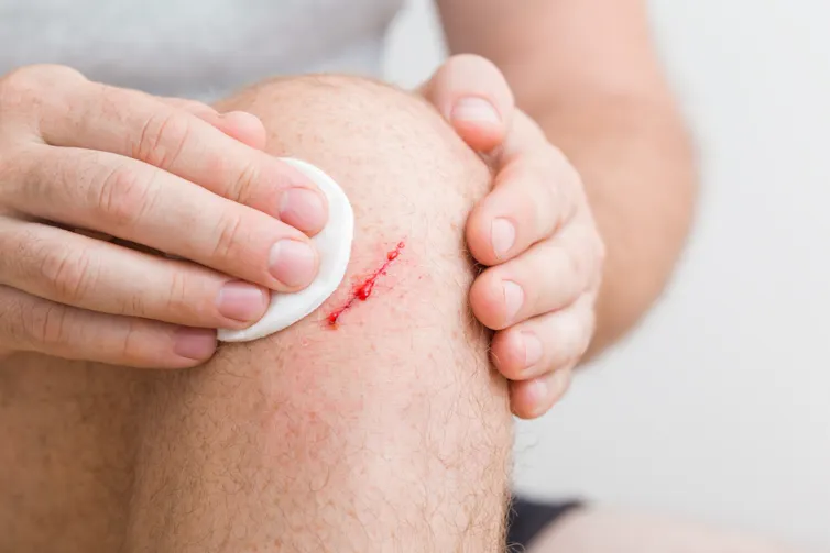 A man with a scratch on his knee.