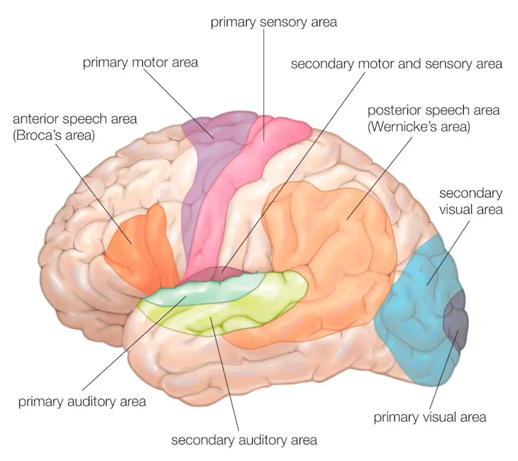 A lateral-view diagram of the human brain, showing the functional areas.