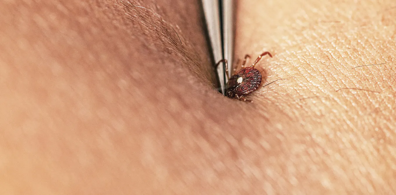 How to avoid tick bites in your yard or while hiking in the woods, and what to do if one starts feasting on you How to avoid tick bites in your yard or while hiking in the woods, and what to do if one starts feasting on you