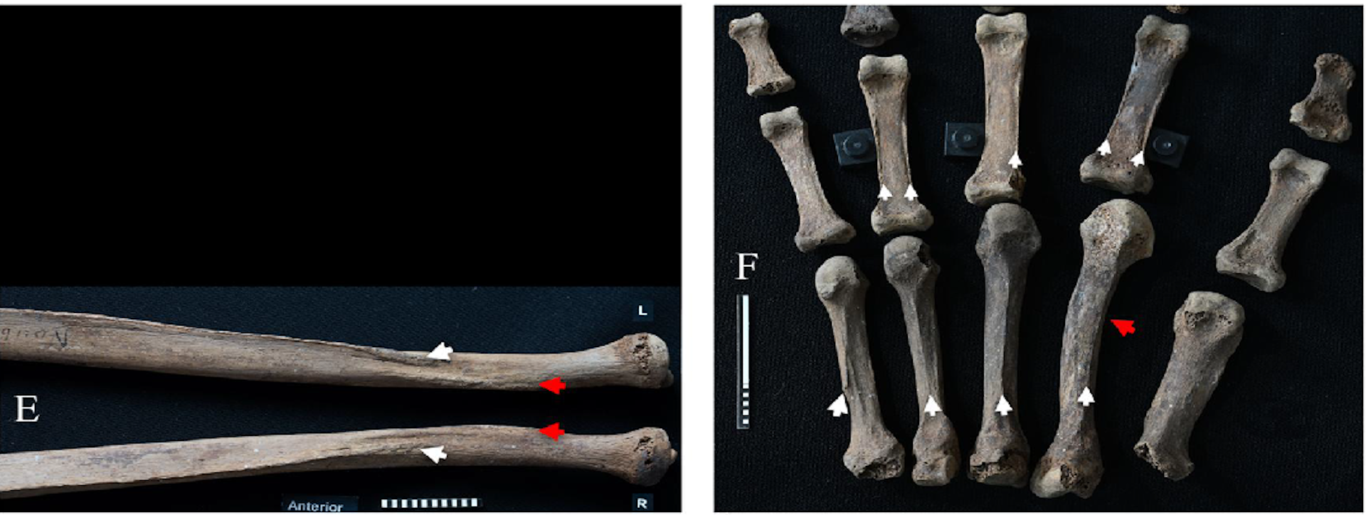 Bilder von Knochen von Armen und Händen.