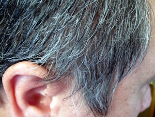 Health Check: why does hair change colour and turn grey?