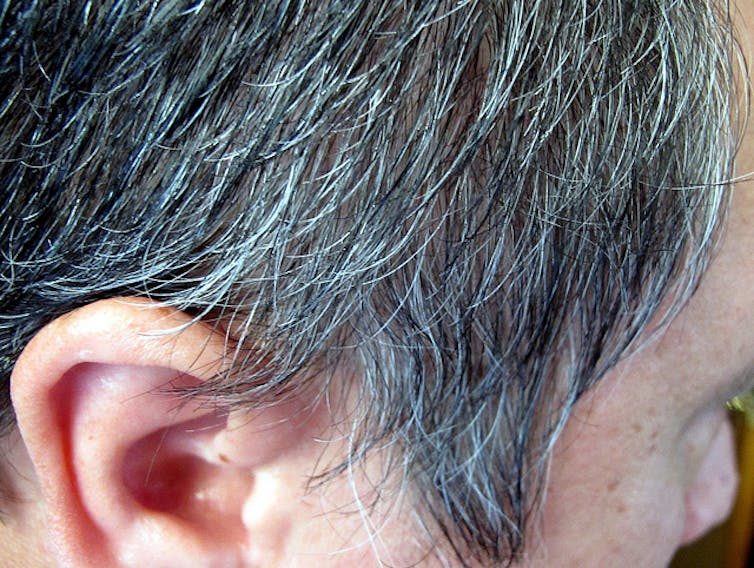 Health Check why does hair change colour and turn grey Health Check why does hair change colour and turn grey
