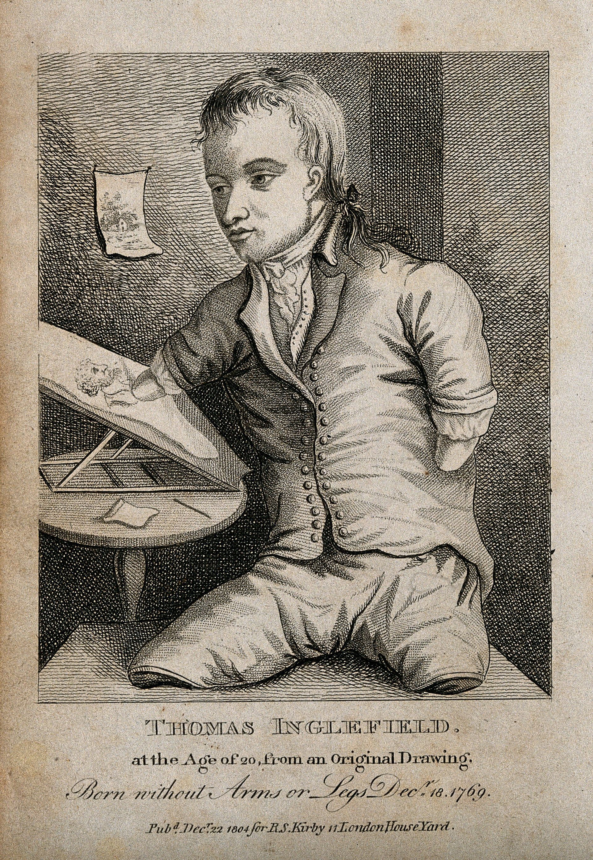 An engraving of a young man without limbs sitting at an artist's easel.