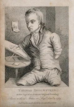 An engraving of a young man without limbs sitting at an artist's easel.
