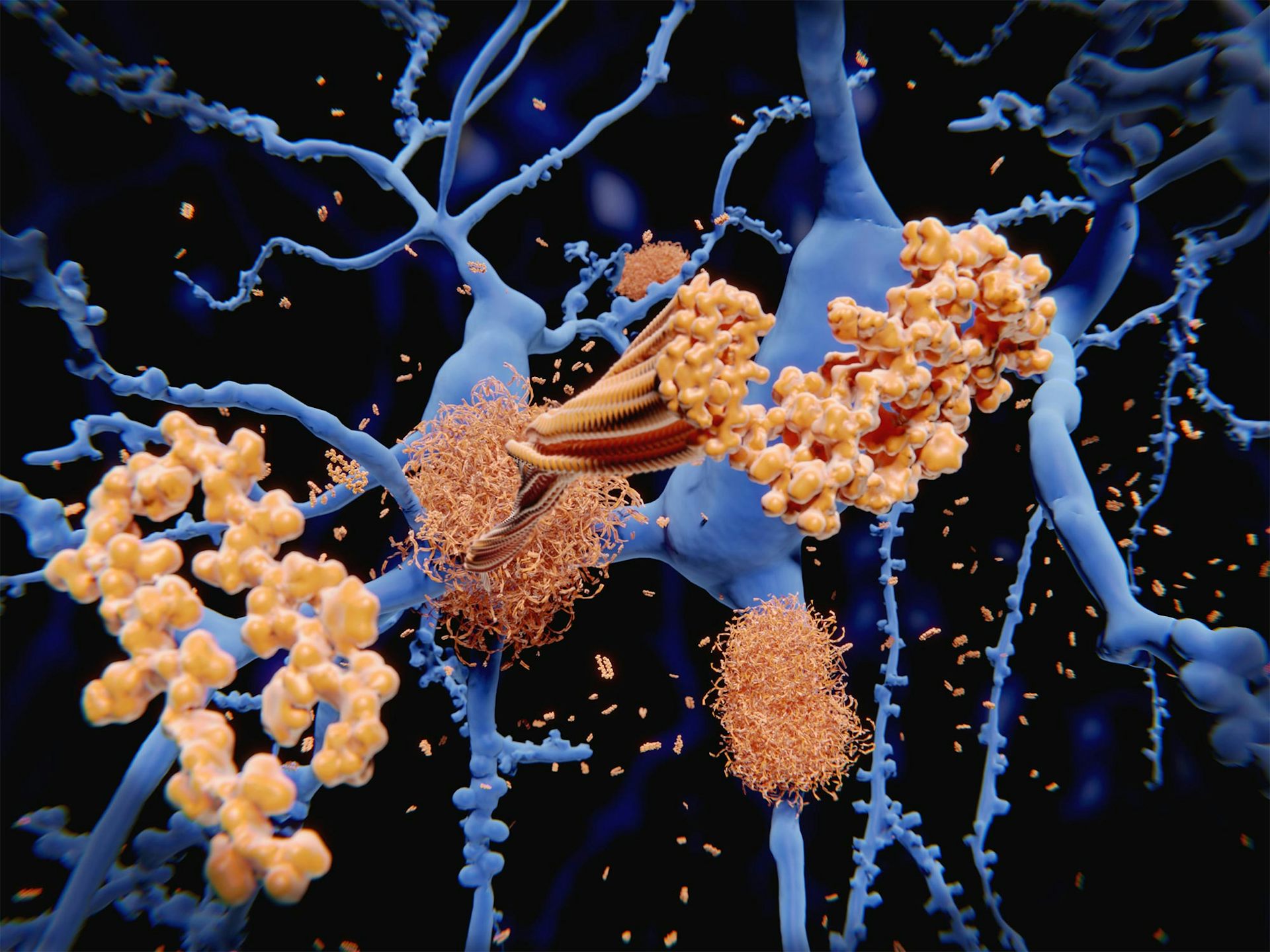 A network of neurons contaminated with yellow deposits