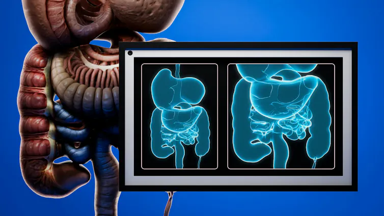 Illustration of human digestive system