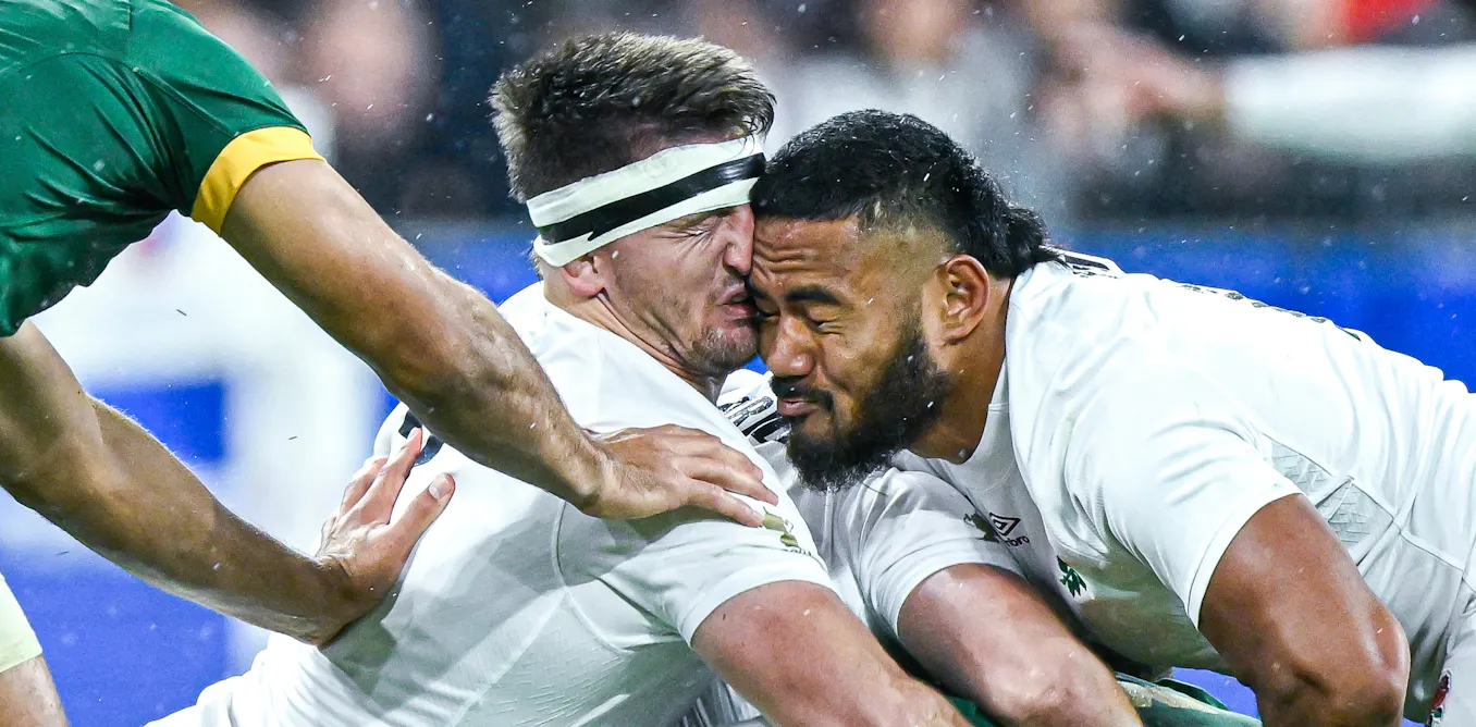 EduWireDaily — What repeated blows to the head in sport may mean for dementia risk
