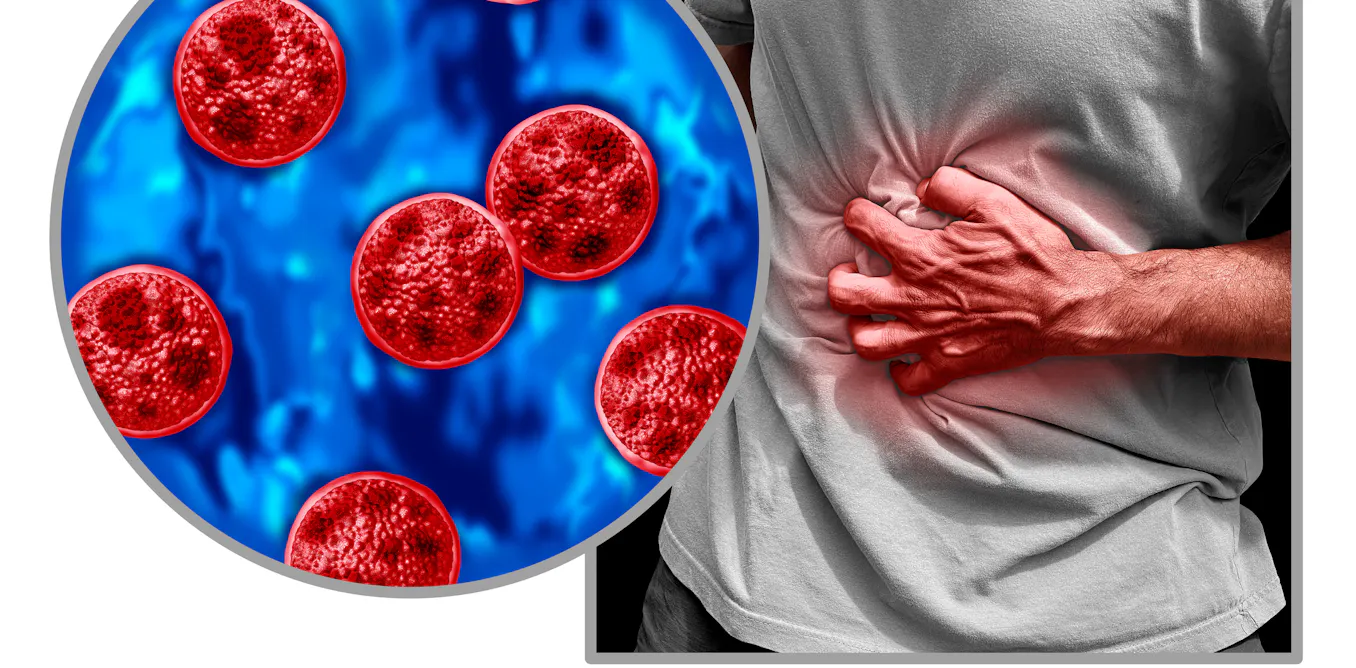Cyclosporiasis sickens some people worse – why your diarrhea could be more explosive than others Cyclosporiasis sickens some people worse – why your diarrhea could be more explosive than others
