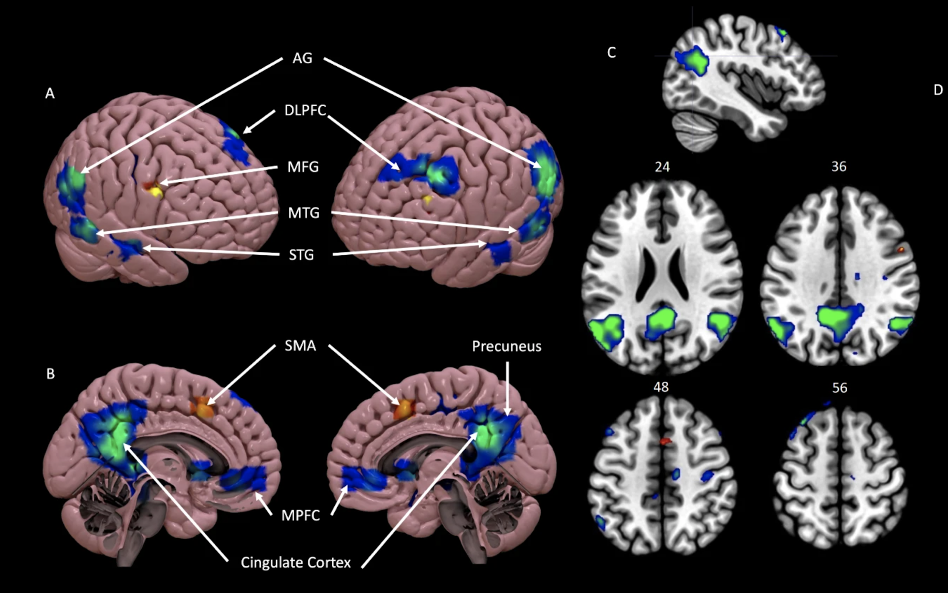 Images of the human brain with blue and green highlighted areas.