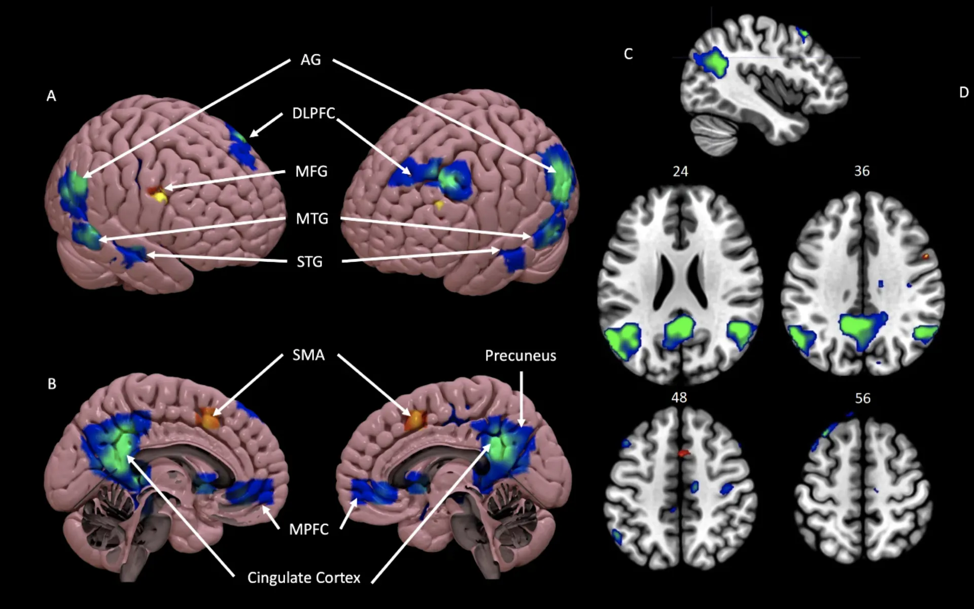 Images of the human brain with blue and green highlighted areas.
