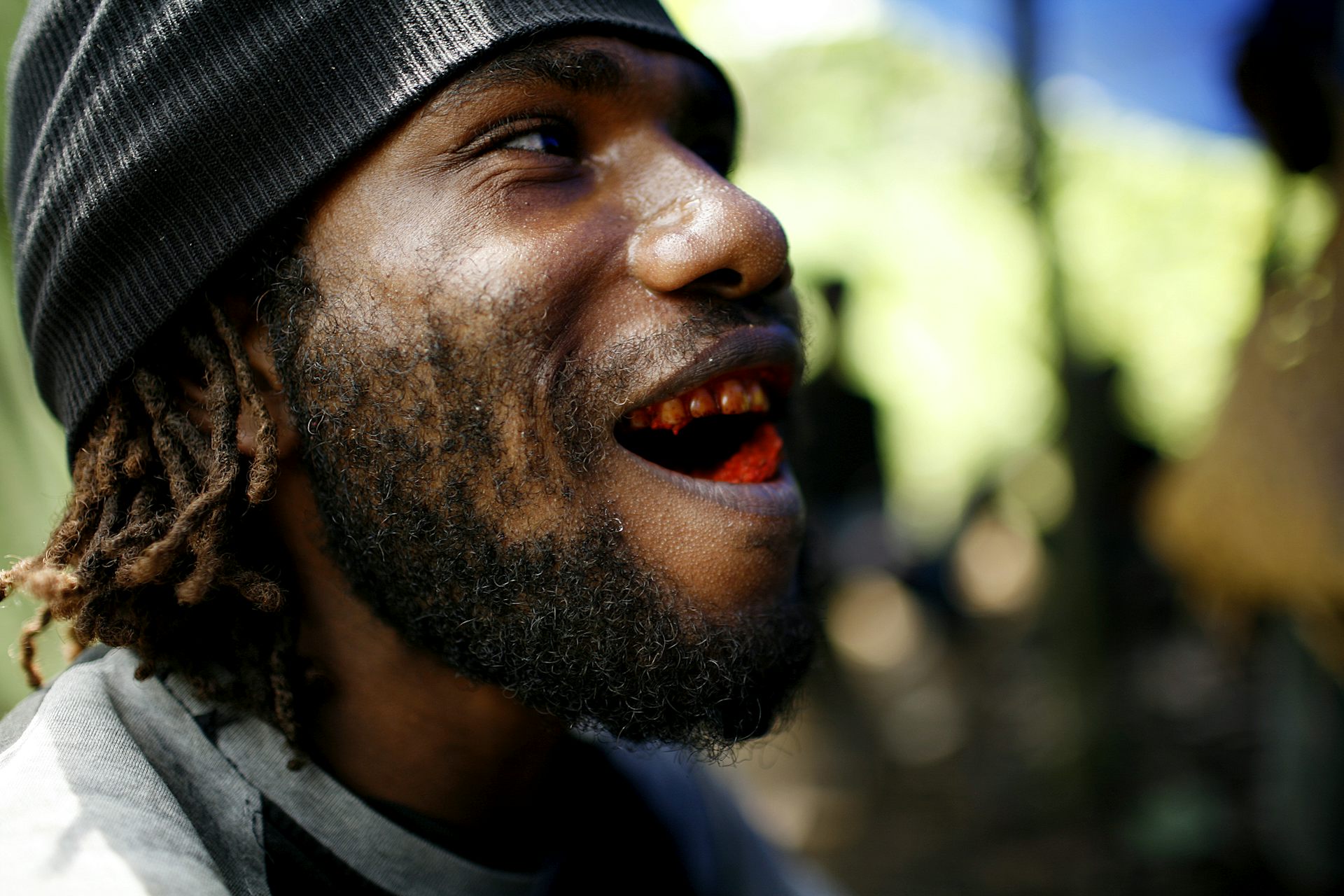 Behind the betel nut smile: the quiet epidemic of oral cancer in Papua New Guinea