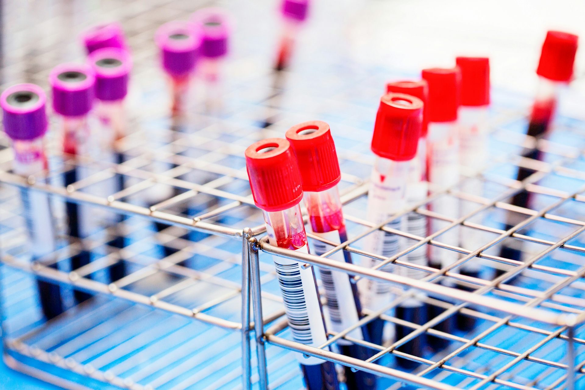 There are new blood tests for Alzheimer’s. Should I have one?