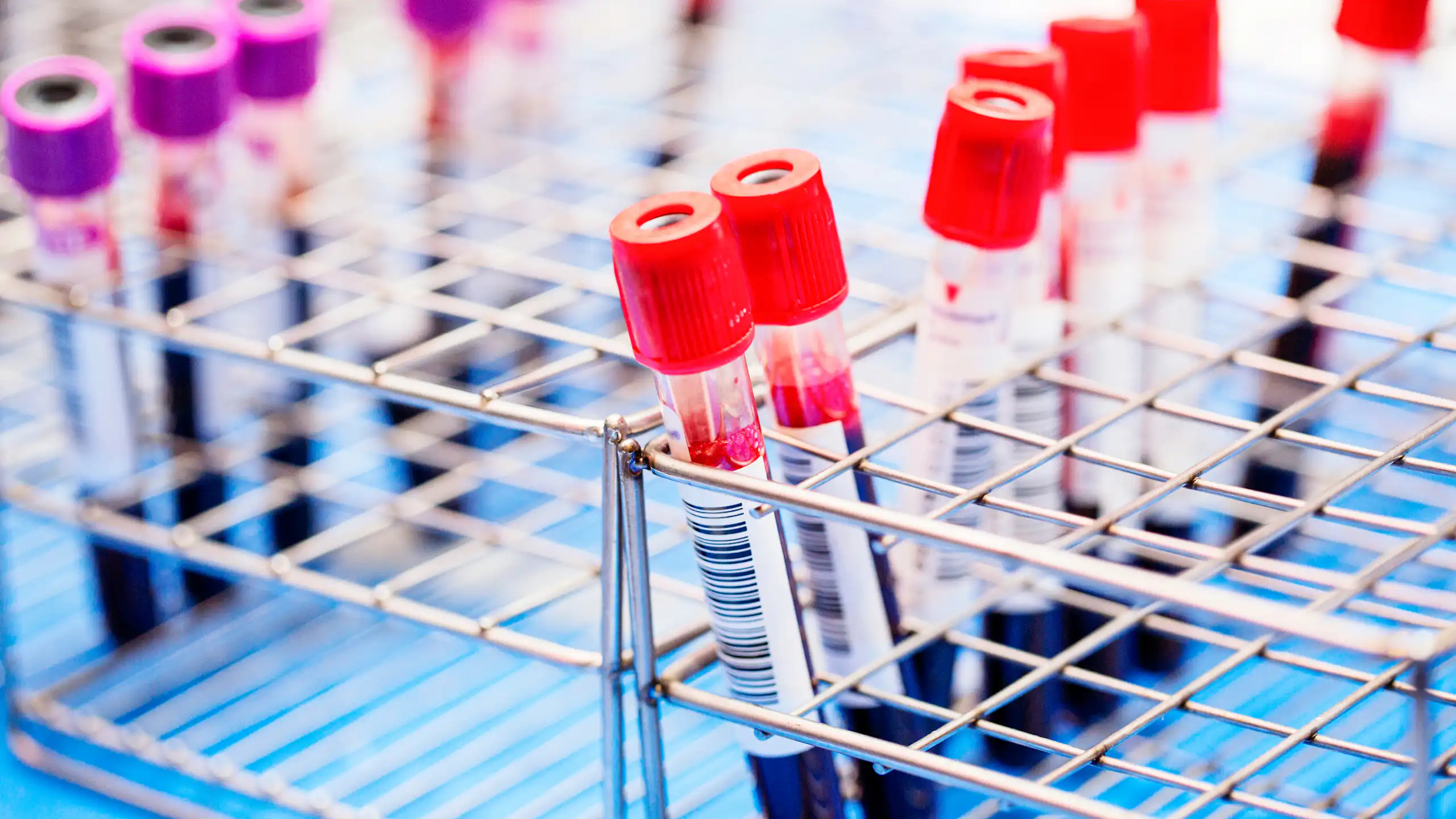 Rows of blood test sample tubes in a rack
