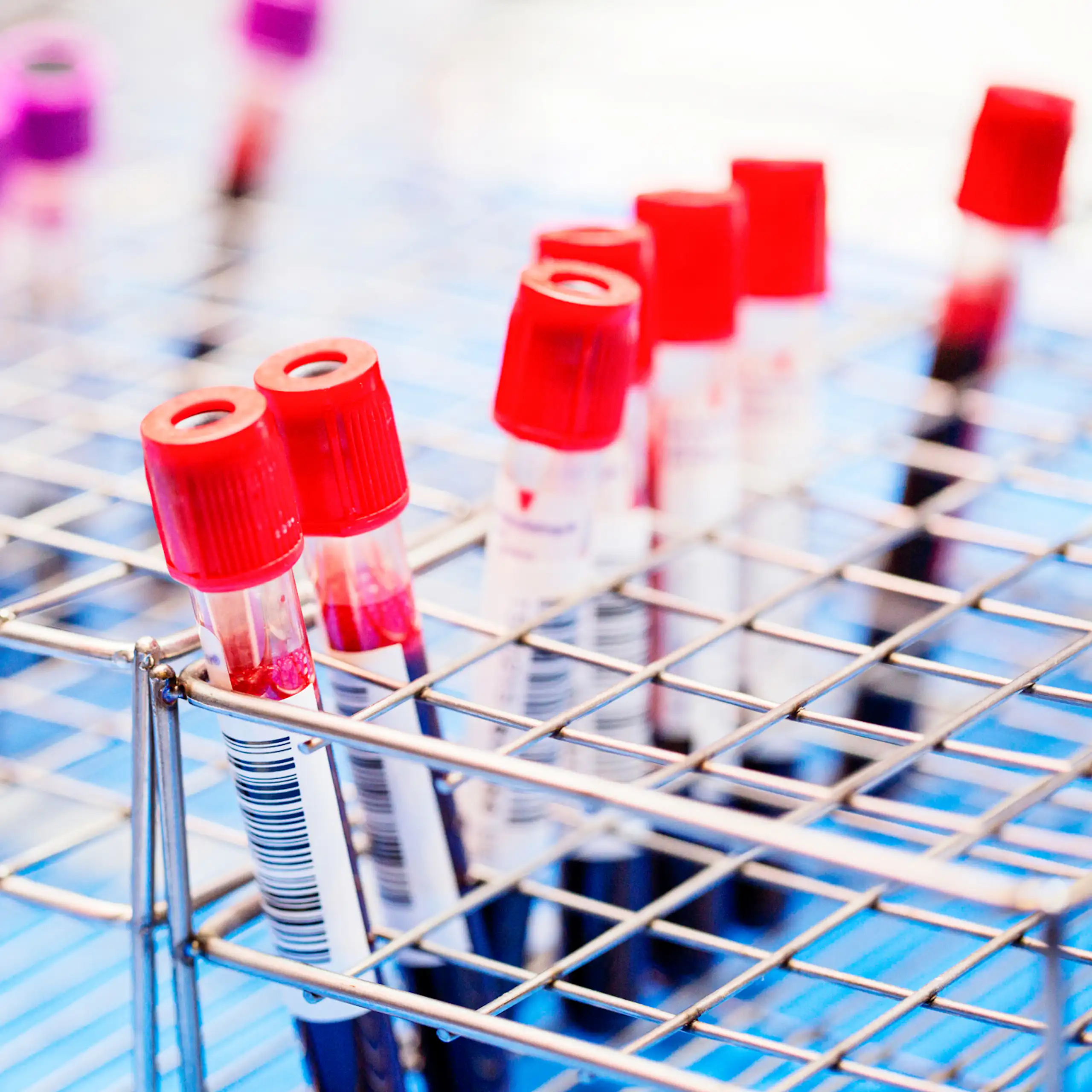 Rows of blood test sample tubes in a rack