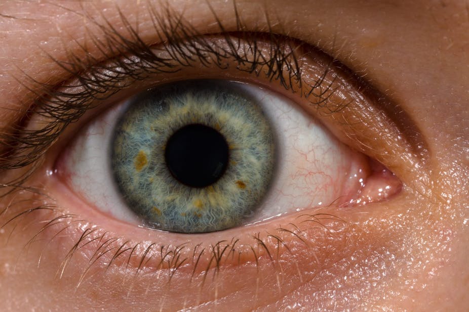 The eye is our window to the brain – and there’s a lot we can tell from it