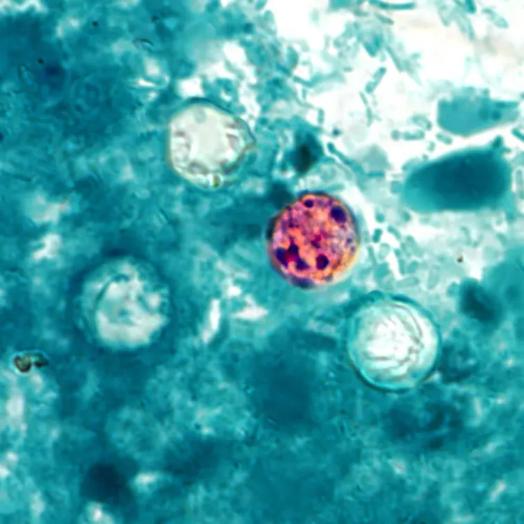 A view through a microscope shows a small colored circle of a cyclospora oocyst.