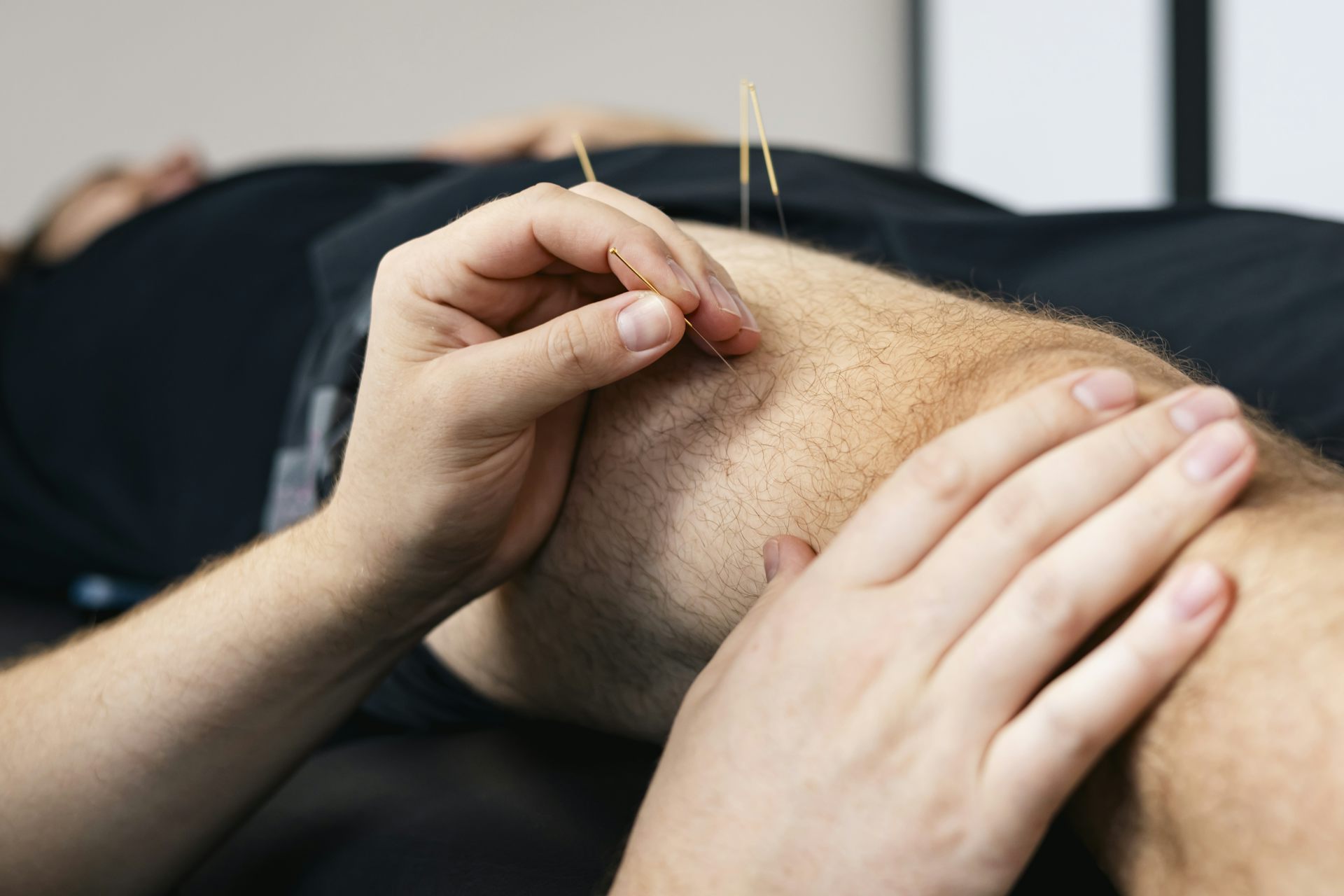 Dry needling is different to acupuncture. So what’s involved? And is it effective?