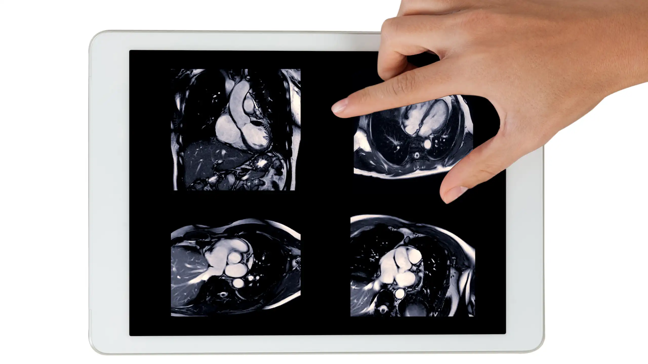 Images d’IRM cardiaque sur tablette