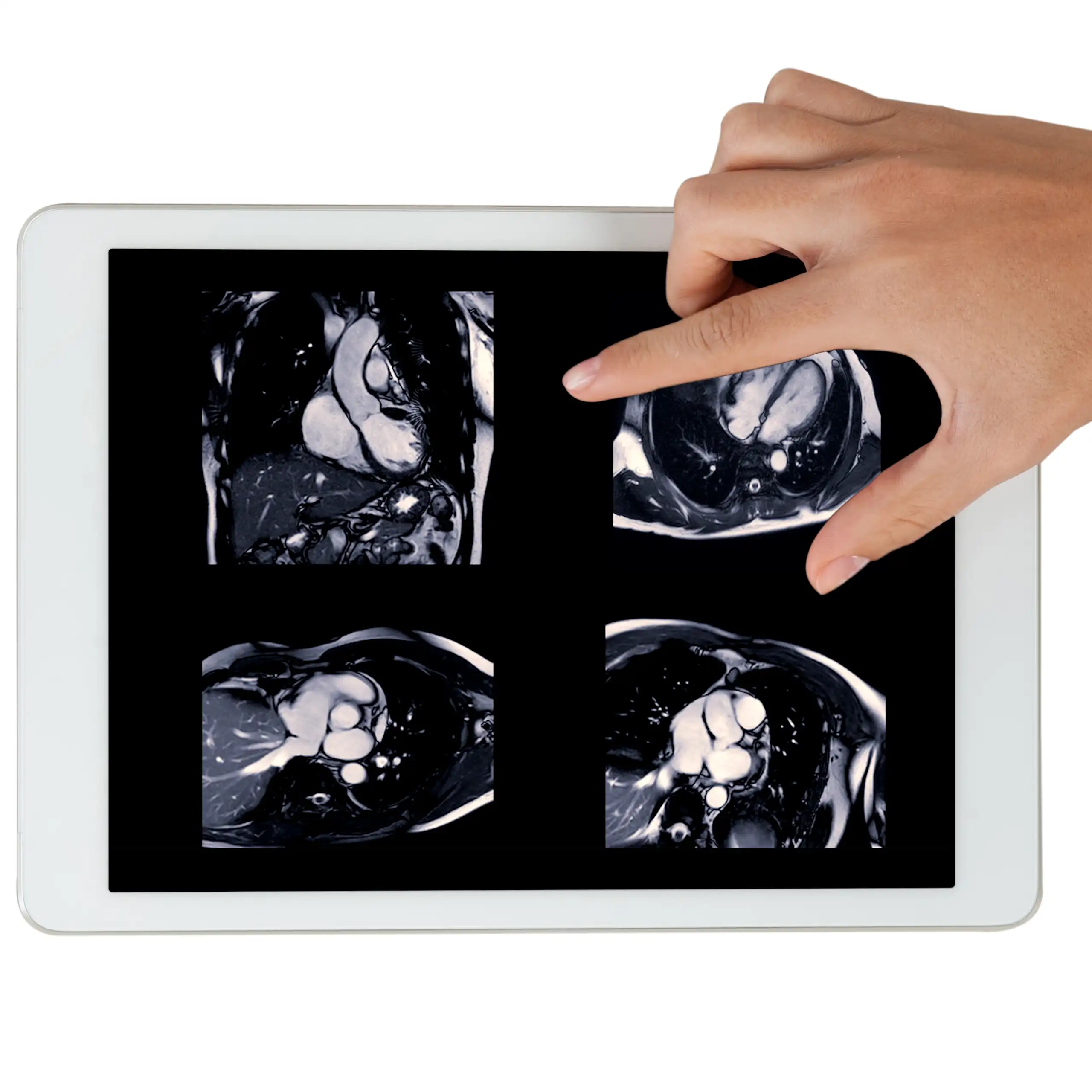 Images d’IRM cardiaque sur tablette