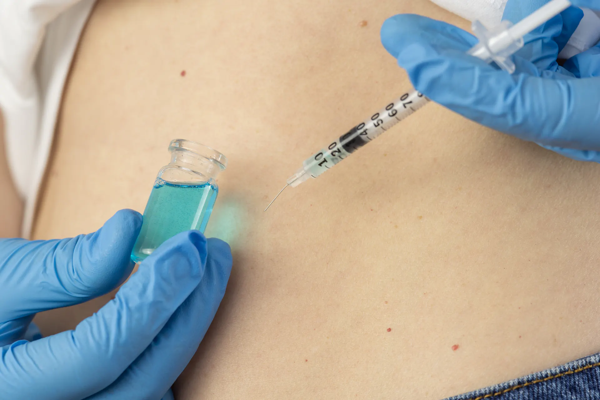 Close-up of a person's torso, and their gloved hands injecting peptides into their belly