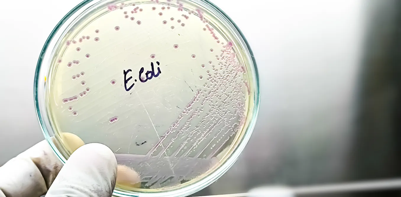 Nature has spent billions of years battling bacteria—AI may unveil its secrets. Nature has spent billions of years battling bacteria—AI may unveil its secrets.